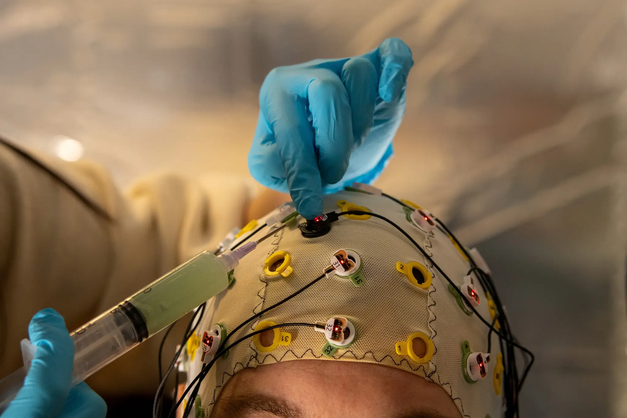 Epilepsy as a Novel Phenotype of BPTF-Related Disorders